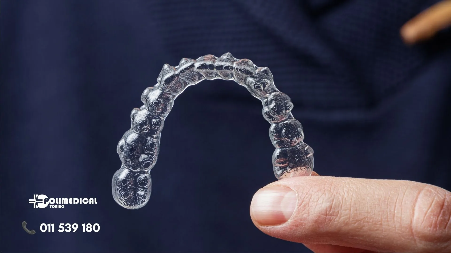 Perché i denti si spostano dopo l’apparecchio? Il ruolo della contenzione - polimedical torino